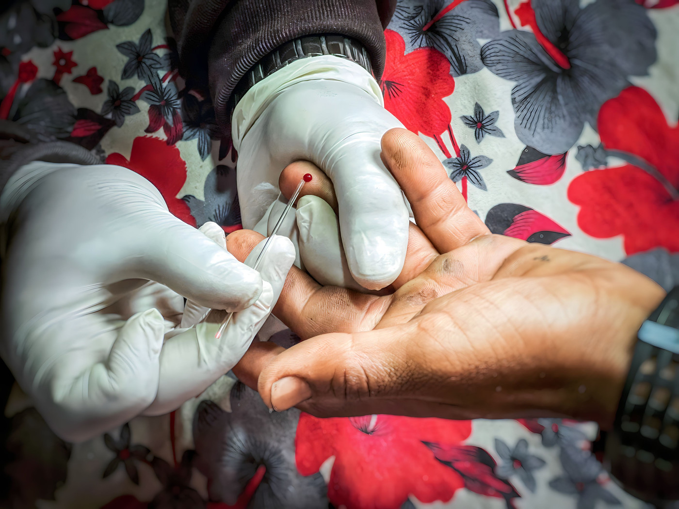 Hepatitis B screening & vaccination &mdash; photo 10